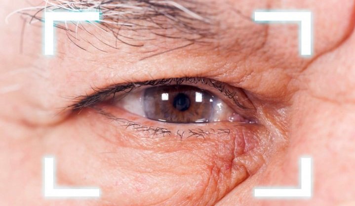 Why Should You Feel Easy When It Comes To Laser Cataract Surgery?