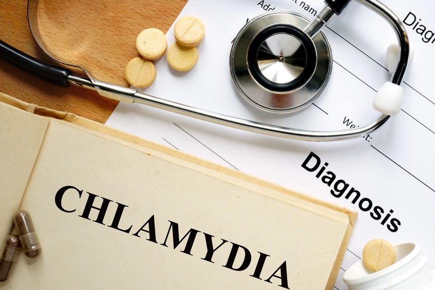 Chlamydia Test Symptoms – Why You Should Get Tested for Chlamydia