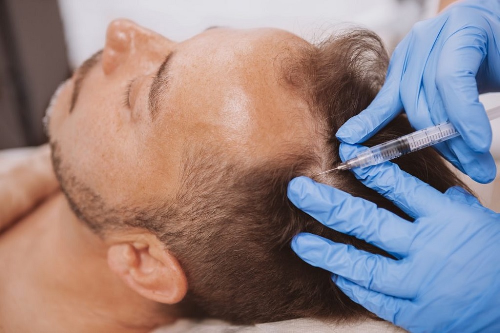 Thinking to Go for Hair Transplant in Turkey? Here’s What to Look for in The Surgeon