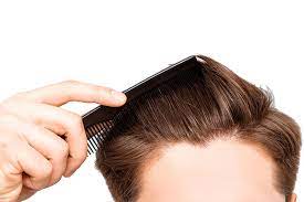 PRP: A NON-INVASIVE HAIR RESTORATION PROCESS