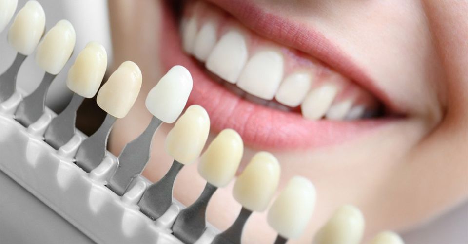 Dental Implant Timeline: Your Quick Guide