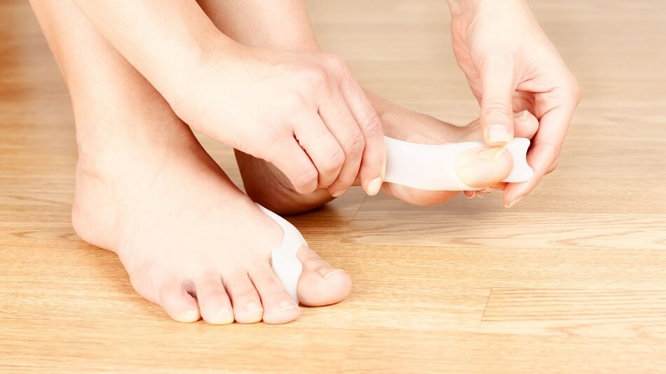What Should You Expect from Hammer Toe Surgery?