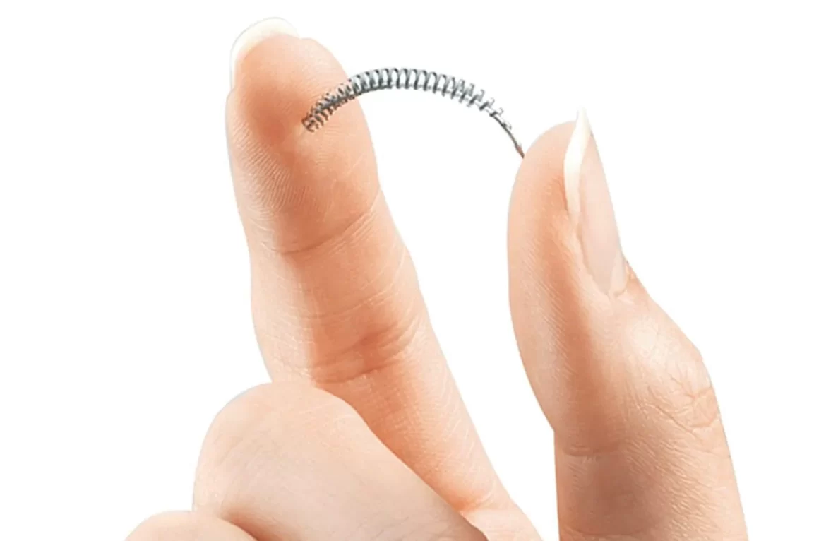 Recovery From Essure Tubal Implants Removal Surgery