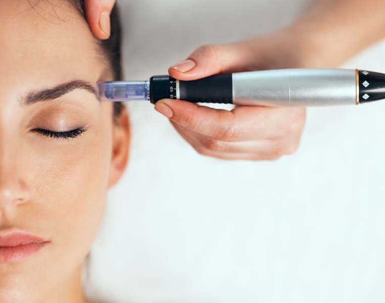 Unveiling The Truth About Microneedling