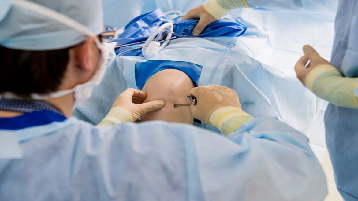 Arthroscopic Surgery: Eligibility And Benefits 