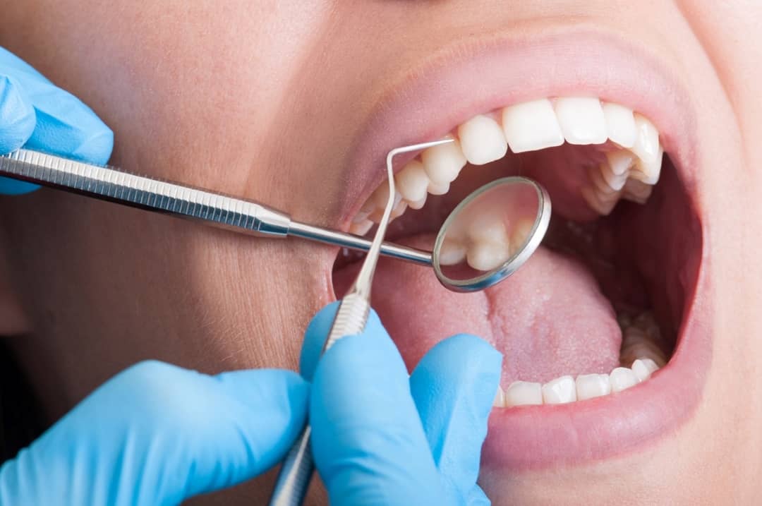 Demystifying Dental Procedures: A Day in the Life of a General Dentist