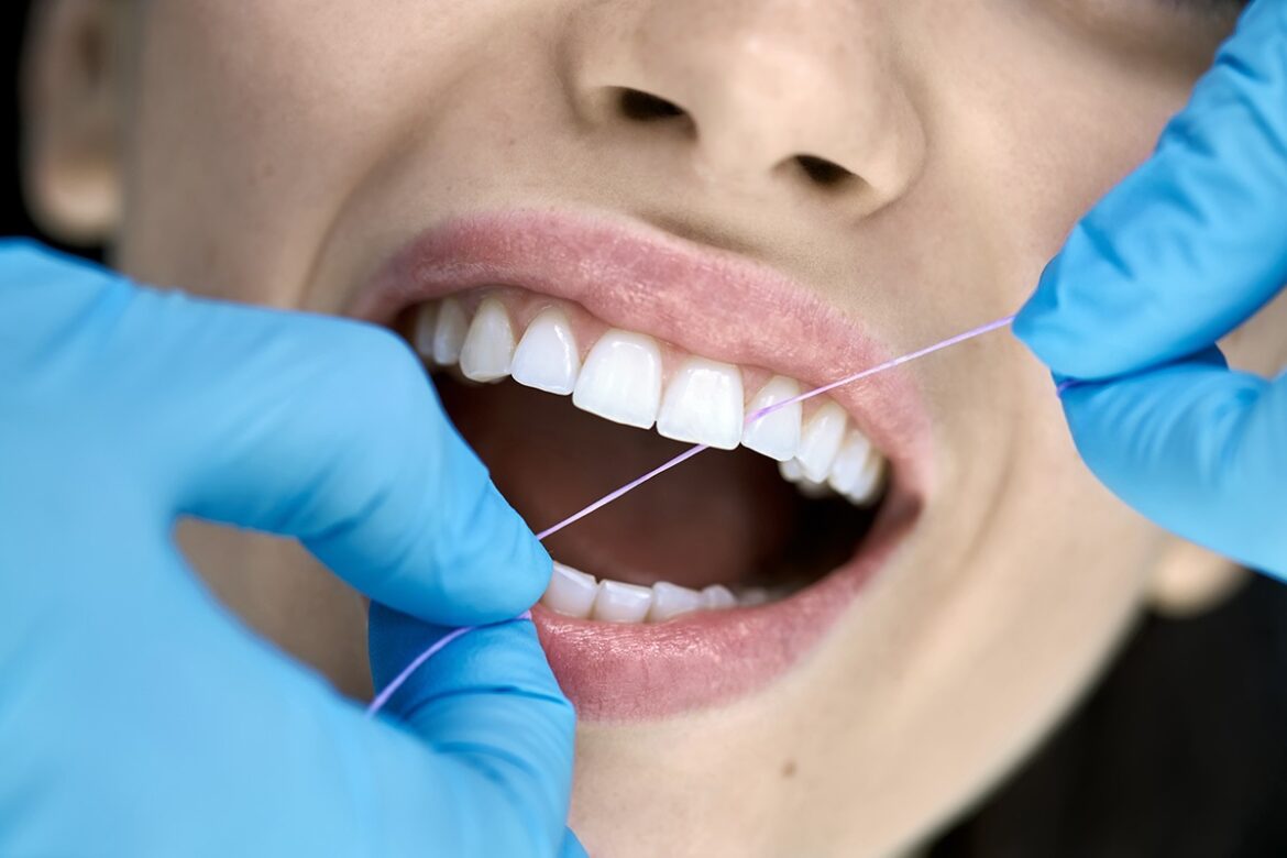 Composite Bonding: An Effective Solution for Cosmetic Dental Issues