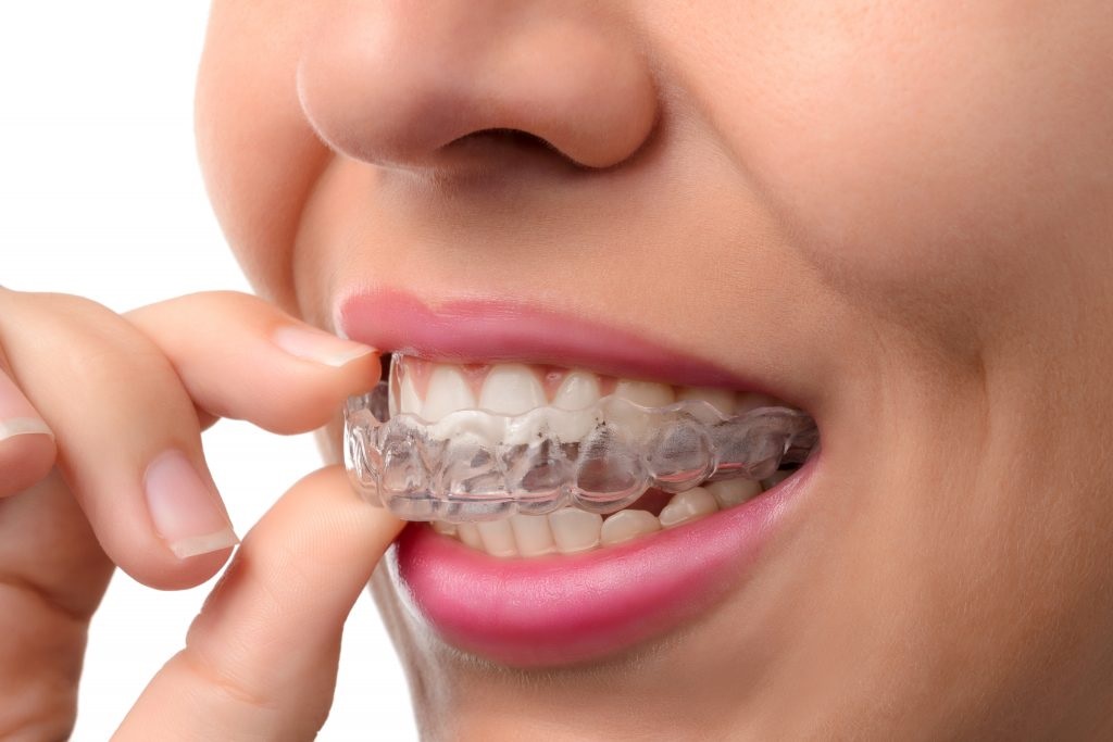 Understanding the Long-Term Benefits of Dental Implants at Teddington Dental Practice