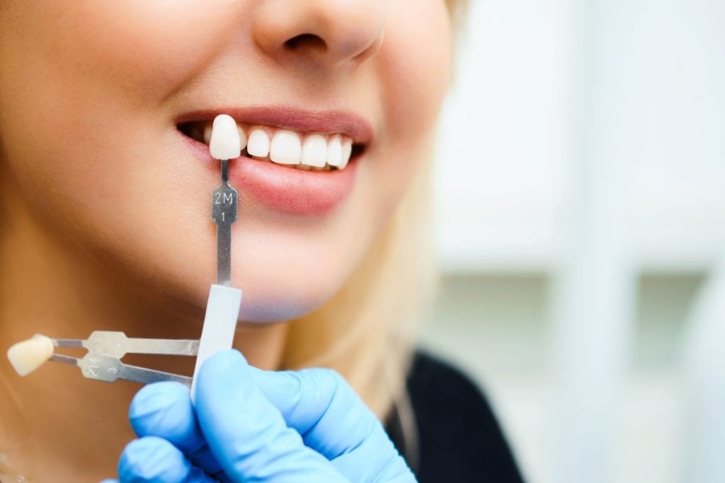 Understanding the Process of Getting Dental Implants in Brentwood