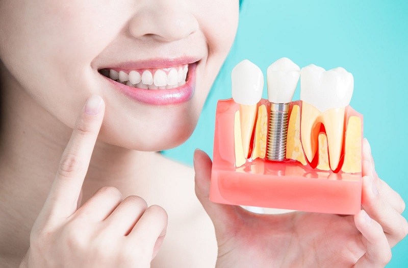 Choosing the Right Dentist for Your Dental Needs in Liverpool