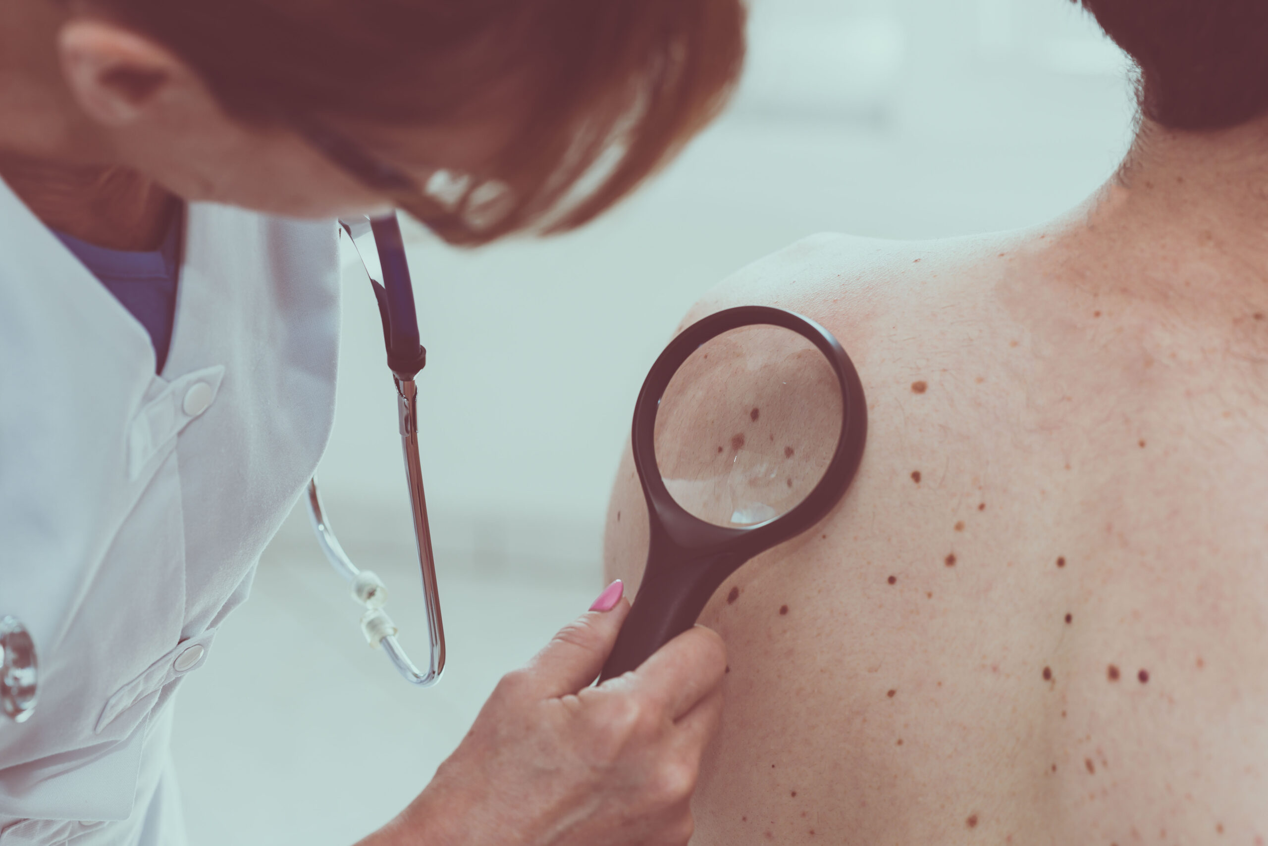How Dermatologists Treat Skin Cancer