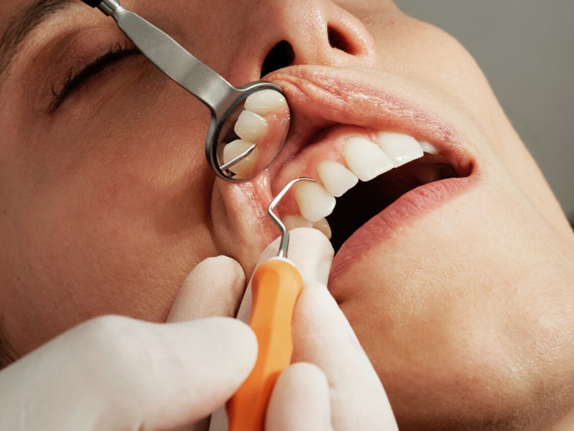 Busting Common Myths About General Dentistry