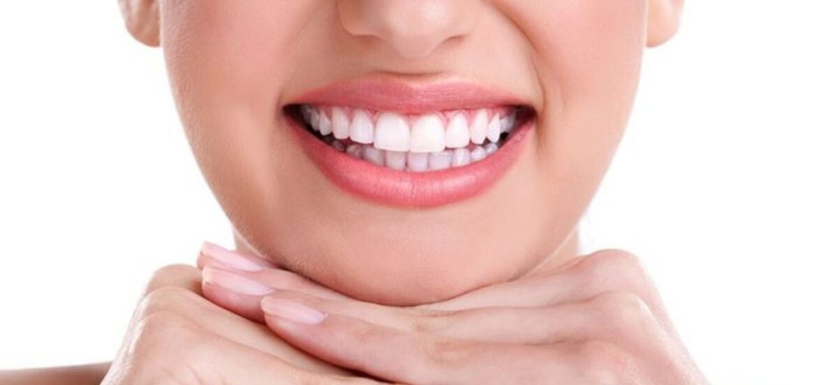 Bright Smiles: The Art of Teeth Whitening in Cosmetic Dentistry