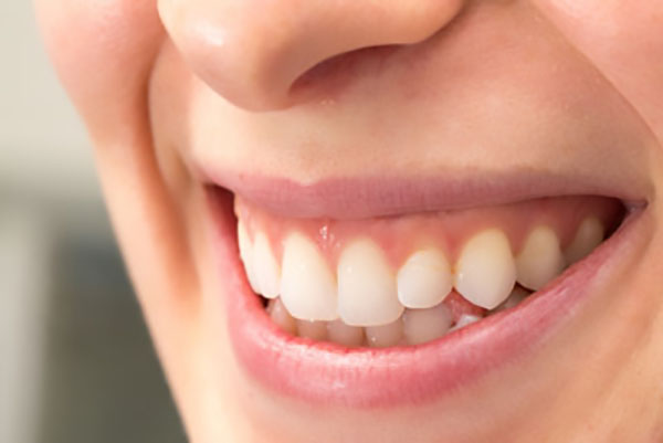 The Importance of Early Dental Visits: What Every Parent Should Know