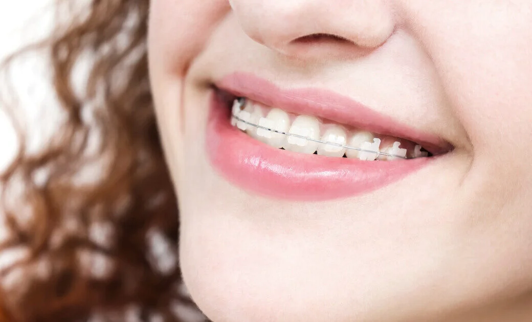 The Rise of Aesthetic Dental Restorations: Why They’re More Popular Than Ever
