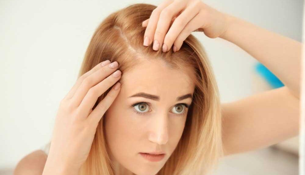 Hair Loss