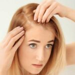 Hair Loss