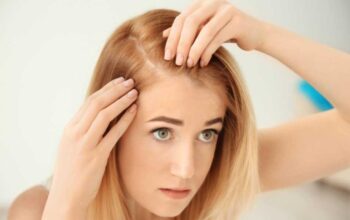 Hair Loss