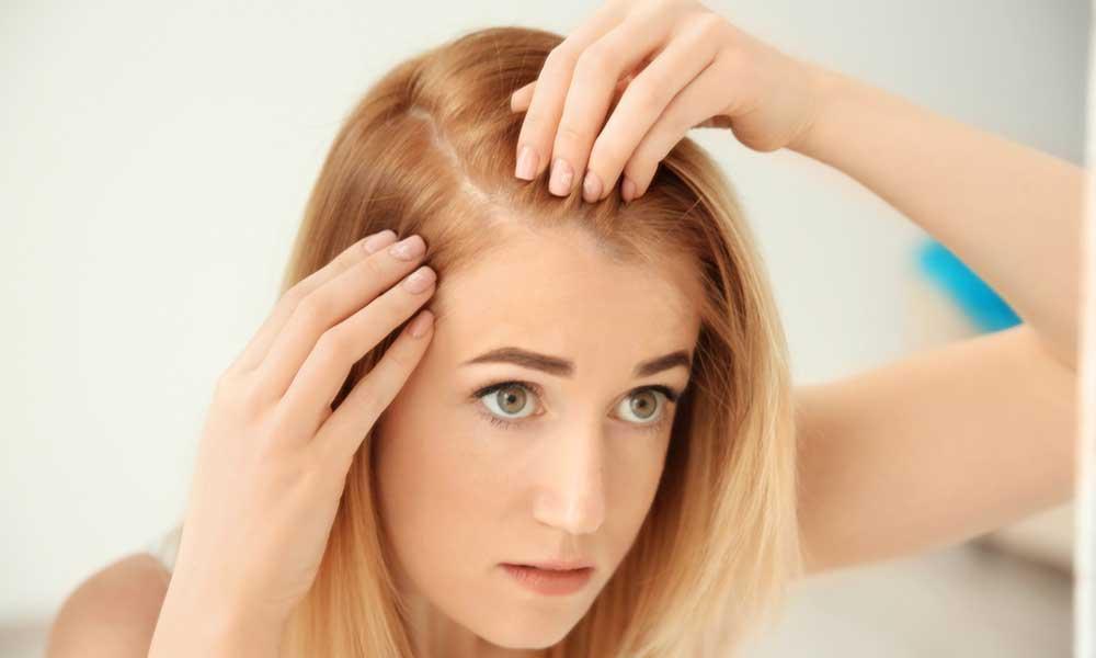 Dealing with Hair Loss? Here’s Why Propecia-Like Options Might Be Your Best Solution