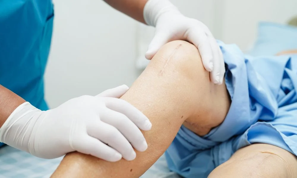 How Long Does It Take to Fully Recover from Knee Replacement Surgery?