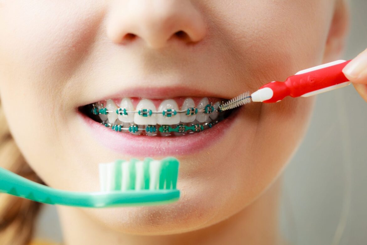 Best Practices for Brushing and Flossing Your Teeth